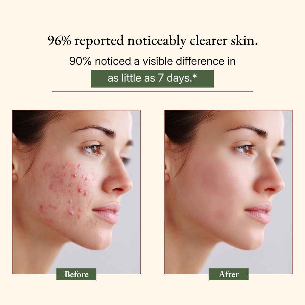 Ayurvedic Neem Soap Bar Green-Beauty Co
