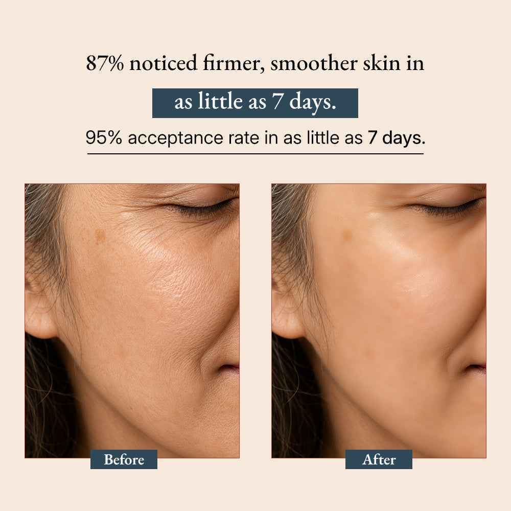 Supercharge Bakuchiol Retinol Serum Green-Beauty Co