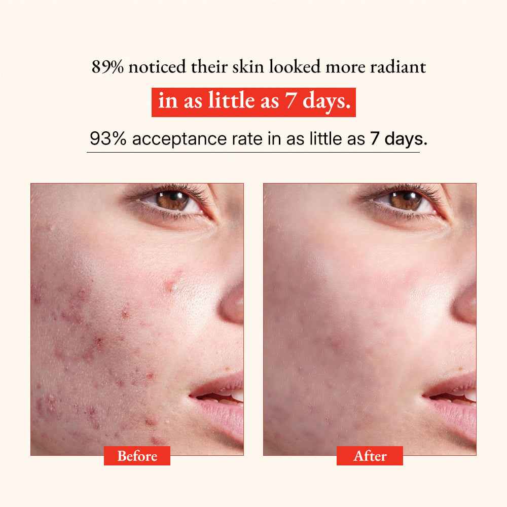 Glow Vitamin C Skin Brightening Serum Green-Beauty Co