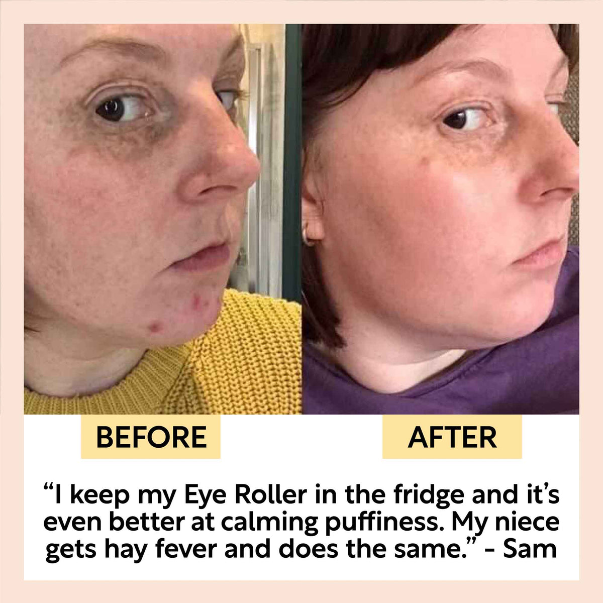 Soothing Eye Roller UpCircle